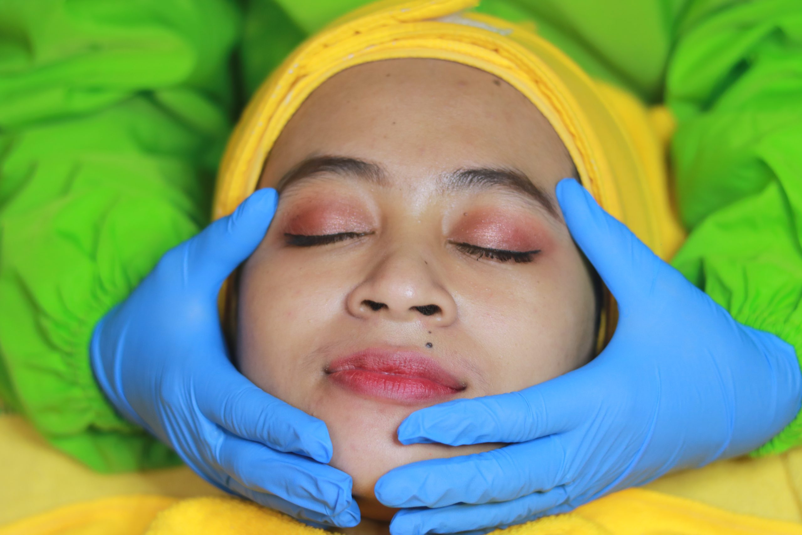 Facial wajah di RSa Aesthetic Clinic Banjaran Bandung