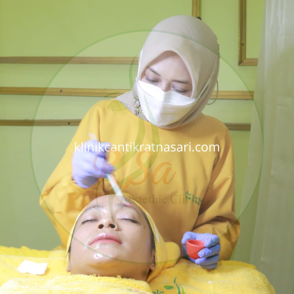 harga chemical peeling bandung
