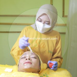 harga chemical peeling bandung