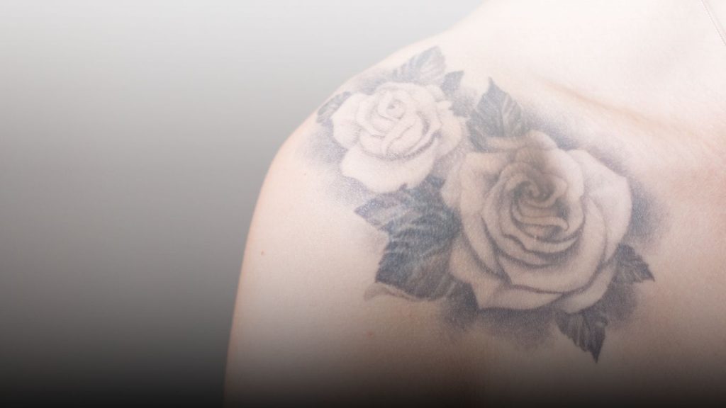 laser tattoo bandung