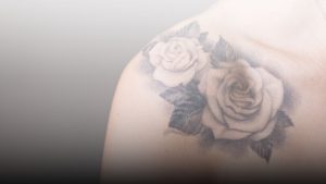 laser tattoo bandung