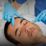 Facial Pria Bandung RSA Aesthetic Clinic
