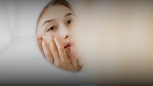 Klinik kecantikan Bandung RSA Aesthetic Clinic untuk treatment wajah dan kulit